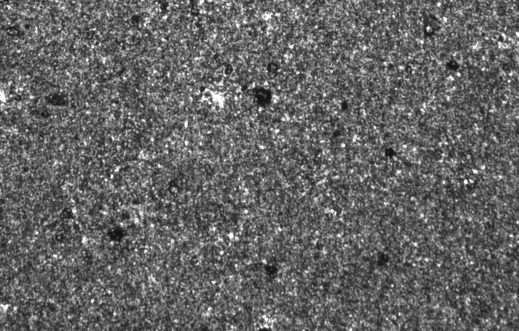 A real scan from the thesis: a machined metal surface at inspection resolution. The even speckle is the healthy texture the model learns to reproduce; the dark pits and bright clusters are the kind of anomaly it has to catch without ever being trained on one.
